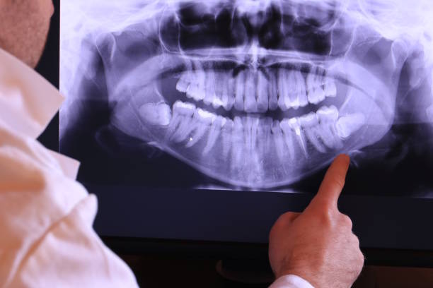 Best Dental Abscess Treatment in Meadows Place, TX