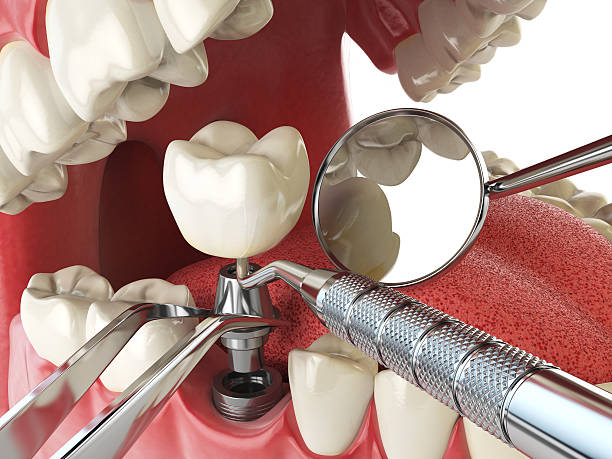 Best Urgent Dental Care for Toothaches in Meadows Place, TX